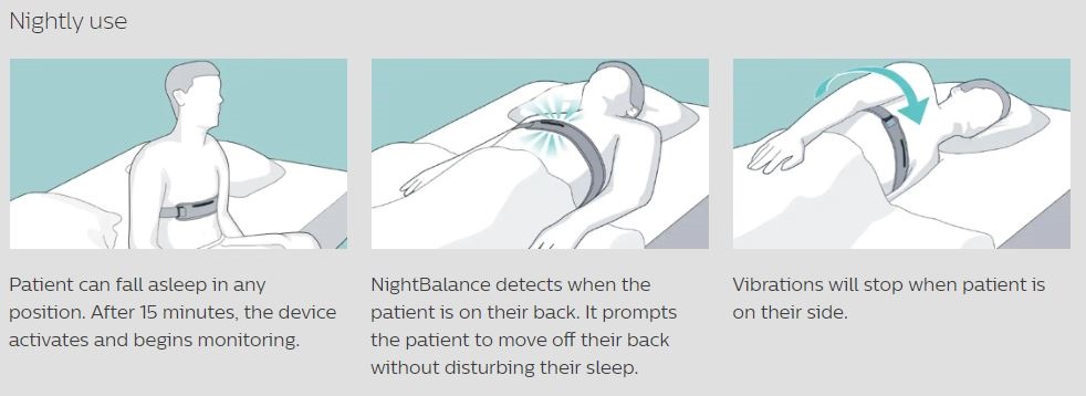 NightBalance Positional Sleep Apnea Treatment