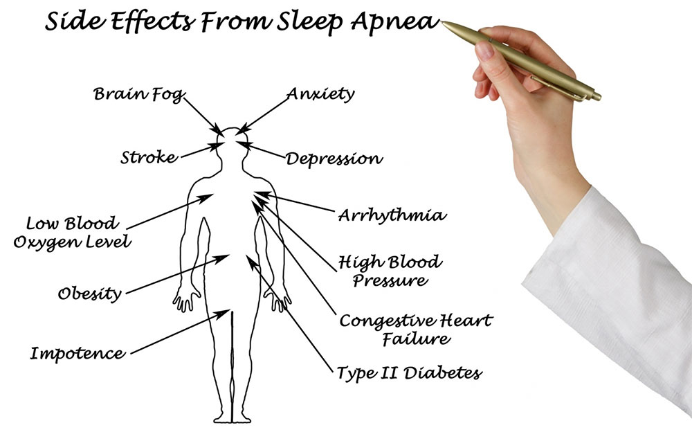 What Exactly Is Sleep Apnea?